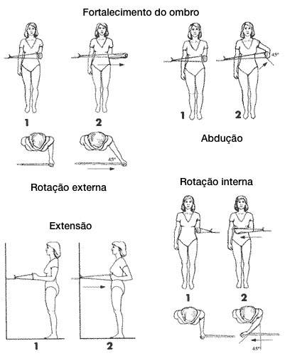 Exercícios para fortalecimento do ombro após luxação ou ombro deslocado