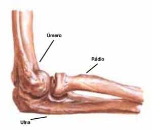 fratura do cotovelo pode estar relacionada a úmero distal, da cabeça do rádio ou da ulna proximal (olécrano)