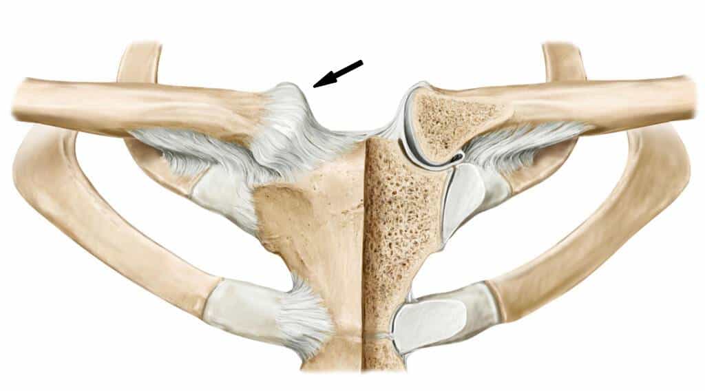 Articulação esternoclavicular (seta)