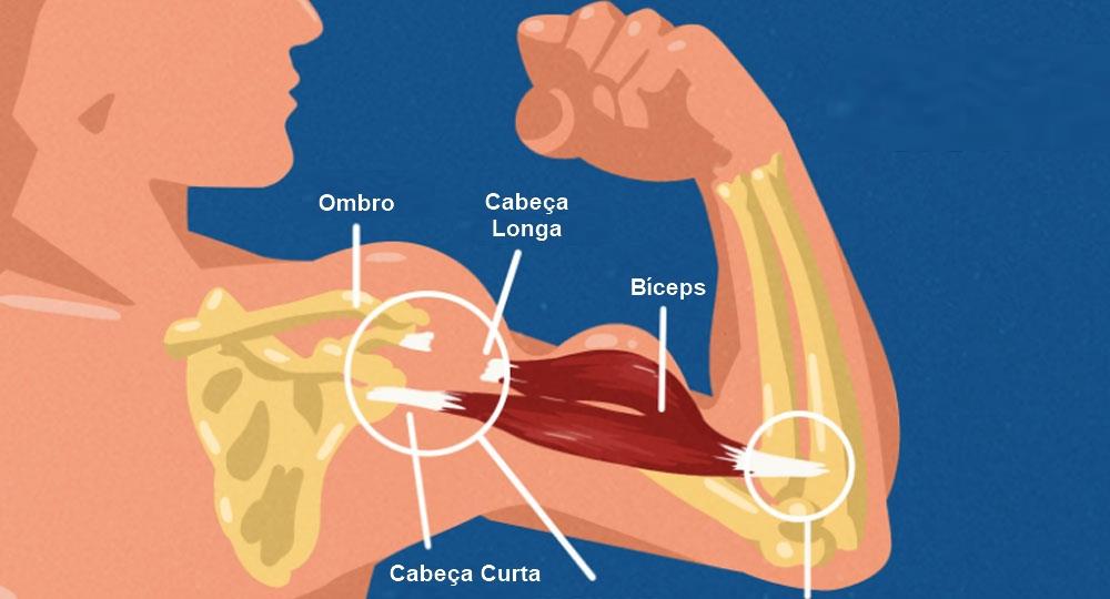 rotura da cabeça longa do bíceps