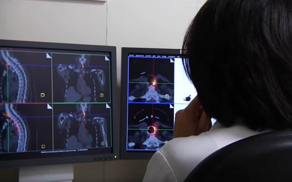 O médico especialista em medicina nuclear analisa as imagens que são colhidas após o exame, fornecendo o laudo