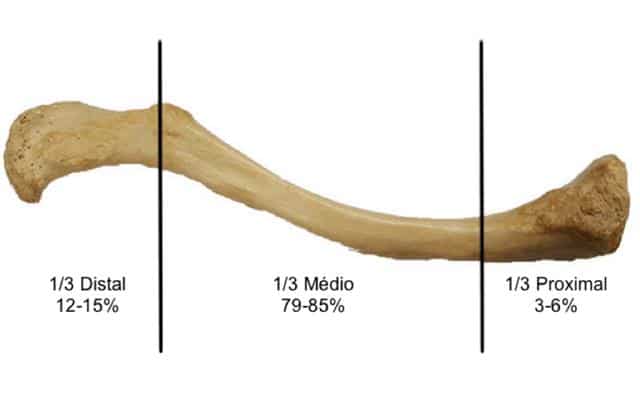 dividimos didadicamente a clavícula em 3 terços e a maioria das fraturas ocorrem no terço médio.